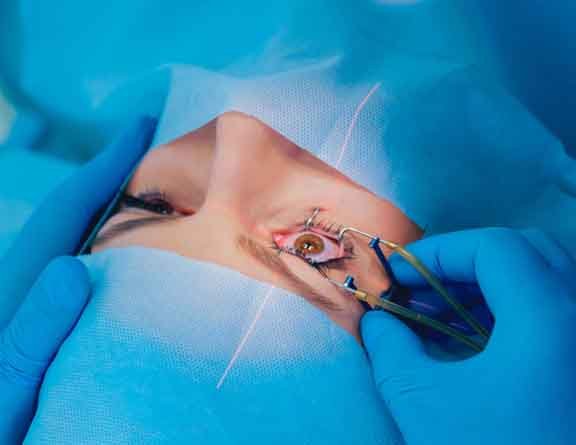 Top Motivations to Pick Max Clinics for LASIK Medical Procedure
